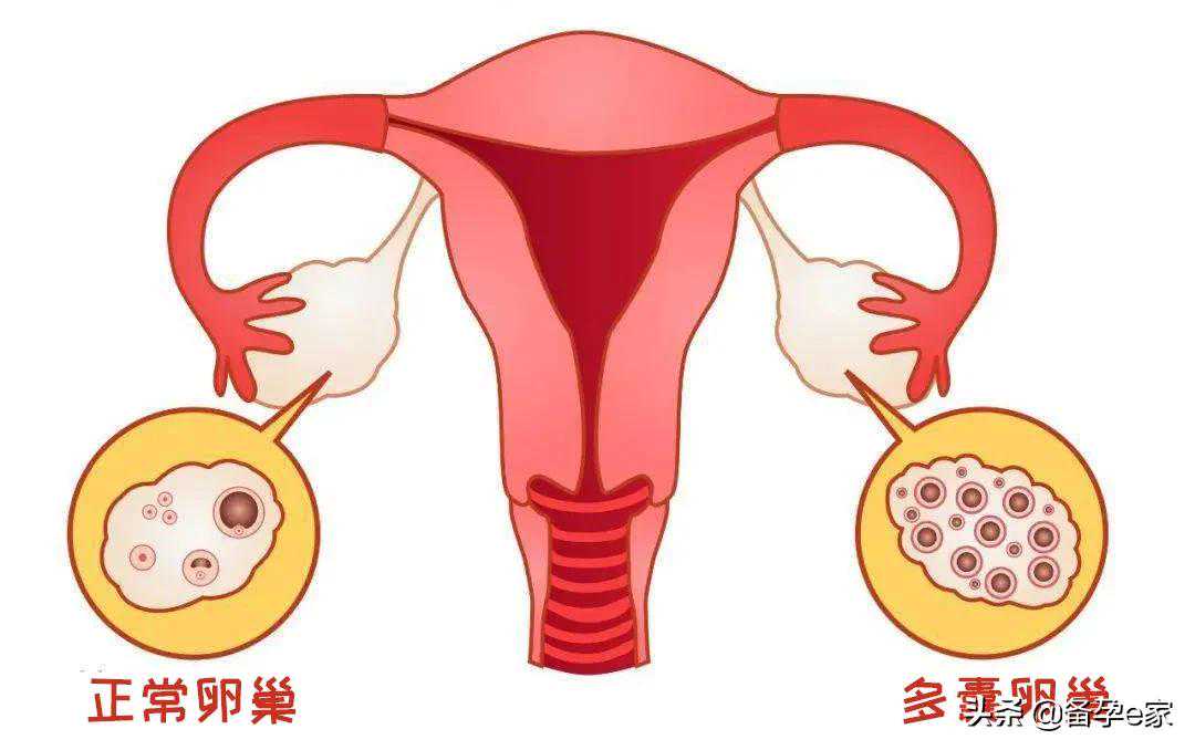 去香港验血多少天知道结果,备孕必知：排卵试纸的这些“秘密”，你读懂了吗
